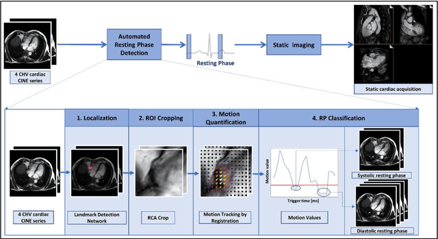 Figure 1 for Automated Cardiac Resting Phase Detection Targeted on the Right Coronary Artery