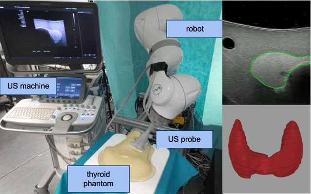 Figure 1 for RSV: Robotic Sonography for Thyroid Volumetry