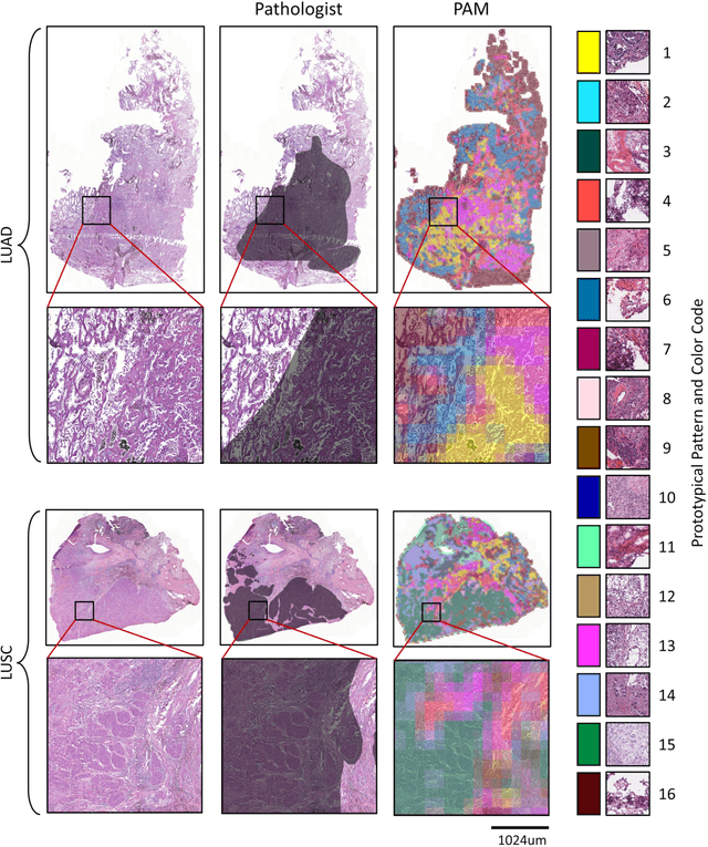 Figure 3 for Handcrafted Histological Transformer (H2T): Unsupervised Representation of Whole Slide Images