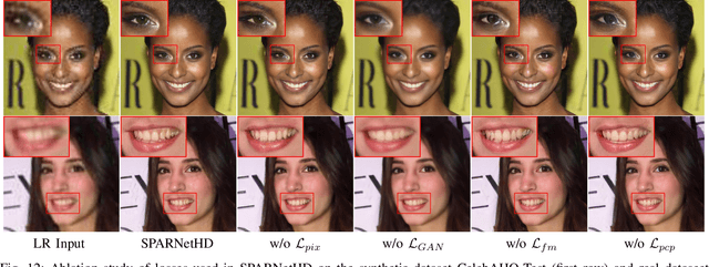 Figure 4 for Learning Spatial Attention for Face Super-Resolution