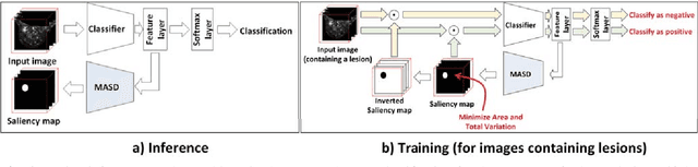 Figure 1 for Model Agnostic Saliency for Weakly Supervised Lesion Detection from Breast DCE-MRI