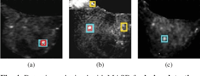 Figure 4 for Model Agnostic Saliency for Weakly Supervised Lesion Detection from Breast DCE-MRI