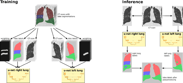 Figure 1 for Automatic segmentation of the pulmonary lobes with a 3D u-net and optimized loss function