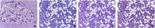 Figure 2 for Deep Learning Framework for Multi-class Breast Cancer Histology Image Classification