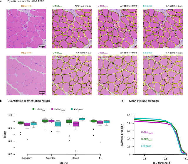 Figure 1 for SYNTA: A novel approach for deep learning-based image analysis in muscle histopathology using photo-realistic synthetic data