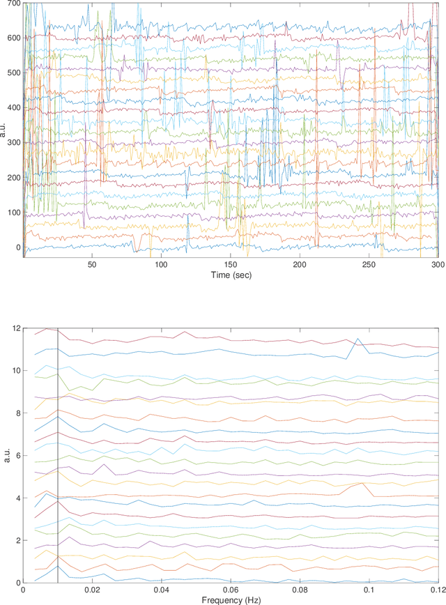 Figure 4 for Calibration for massive physiological signal collection in hospital -- Sawtooth artifact in beat-to-beat pulse transit time measured from patient monitor data