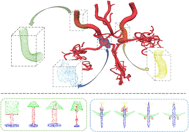 Figure 1 for 3D Medical Point Transformer: Introducing Convolution to Attention Networks for Medical Point Cloud Analysis