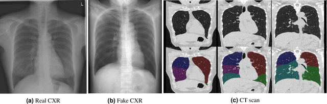 Figure 3 for Automated Estimation of Total Lung Volume using Chest Radiographs and Deep Learning