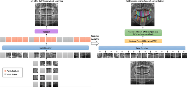Figure 1 for Self-Supervised Learning with Masked Image Modeling for Teeth Numbering, Detection of Dental Restorations, and Instance Segmentation in Dental Panoramic Radiographs