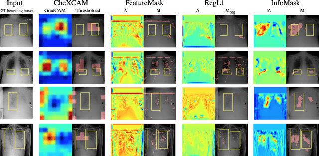 Figure 4 for InfoMask: Masked Variational Latent Representation to Localize Chest Disease