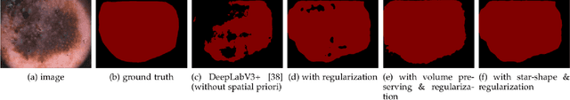 Figure 1 for Deep Convolutional Neural Networks with Spatial Regularization, Volume and Star-shape Priori for Image Segmentation