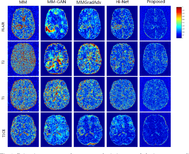 Figure 2 for A Learnable Variational Model for Joint Multimodal MRI Reconstruction and Synthesis