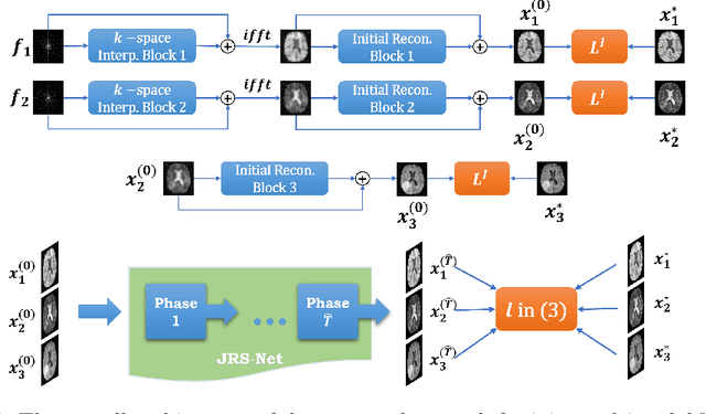 Figure 1 for A Learnable Variational Model for Joint Multimodal MRI Reconstruction and Synthesis