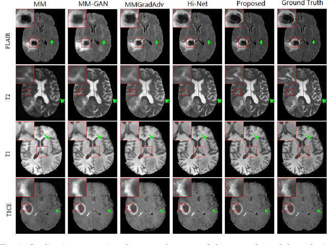 Figure 4 for A Learnable Variational Model for Joint Multimodal MRI Reconstruction and Synthesis