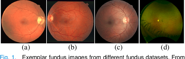 Figure 1 for Unsupervised Domain Adaptation for Retinal Vessel Segmentation with Adversarial Learning and Transfer Normalization