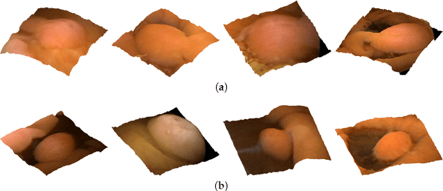 Figure 3 for Polyp Detection and Segmentation from Video Capsule Endoscopy: A Review