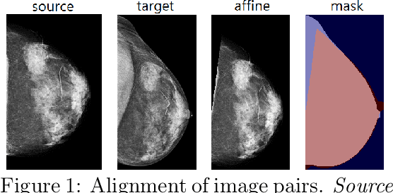 Figure 1 for Screening Mammogram Classification with Prior Exams