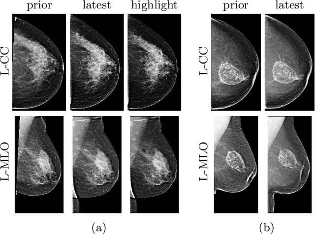 Figure 4 for Screening Mammogram Classification with Prior Exams