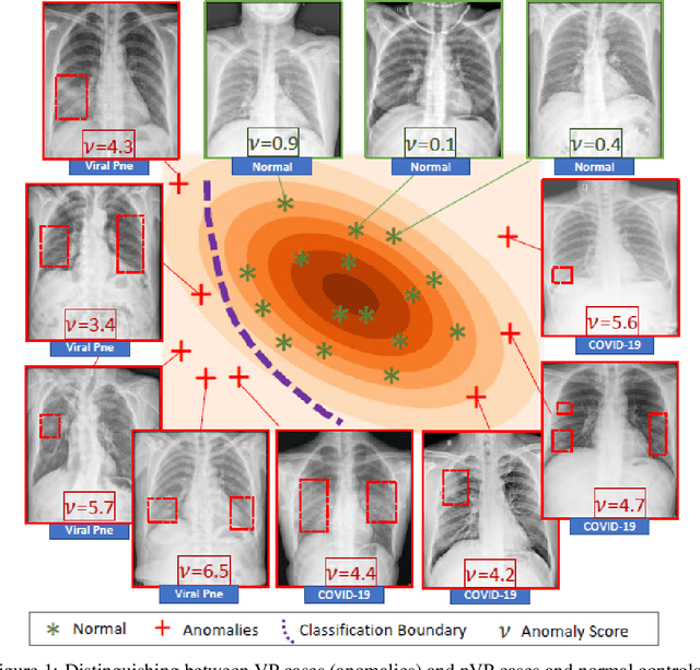 Figure 1 for Deep Neural Networks for COVID-19 Detection and Diagnosis using Images and Acoustic-based Techniques: A Recent Review