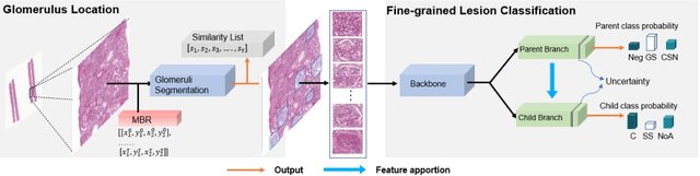 Figure 2 for Automatic Fine-grained Glomerular Lesion Recognition in Kidney Pathology