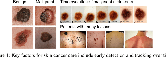 Figure 1 for Skin Cancer Detection and Tracking using Data Synthesis and Deep Learning