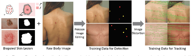Figure 2 for Skin Cancer Detection and Tracking using Data Synthesis and Deep Learning