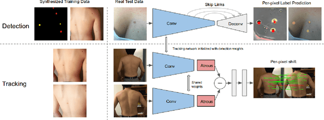 Figure 3 for Skin Cancer Detection and Tracking using Data Synthesis and Deep Learning