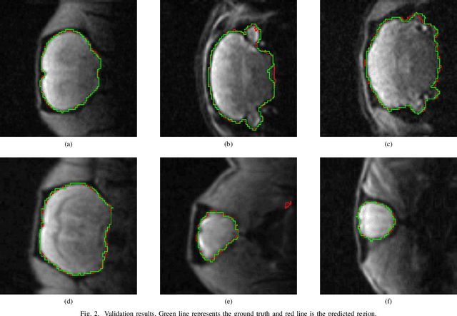 Figure 2 for A deep learning based tool for automatic brain extraction from functional magnetic resonance images in rodents