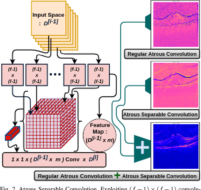 Figure 2 for Optic-Net: A Novel Convolutional Neural Network for Diagnosis of Retinal Diseases from Optical Tomography Images