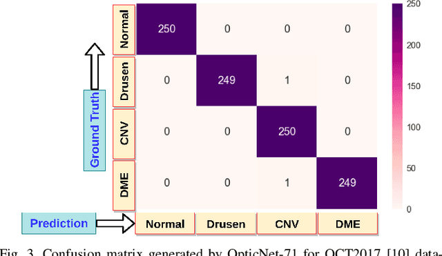 Figure 3 for Optic-Net: A Novel Convolutional Neural Network for Diagnosis of Retinal Diseases from Optical Tomography Images