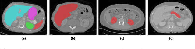 Figure 1 for Multi-organ Segmentation via Co-training Weight-averaged Models from Few-organ Datasets