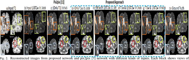 Figure 2 for Semantic Features Aided Multi-Scale Reconstruction of Inter-Modality Magnetic Resonance Images