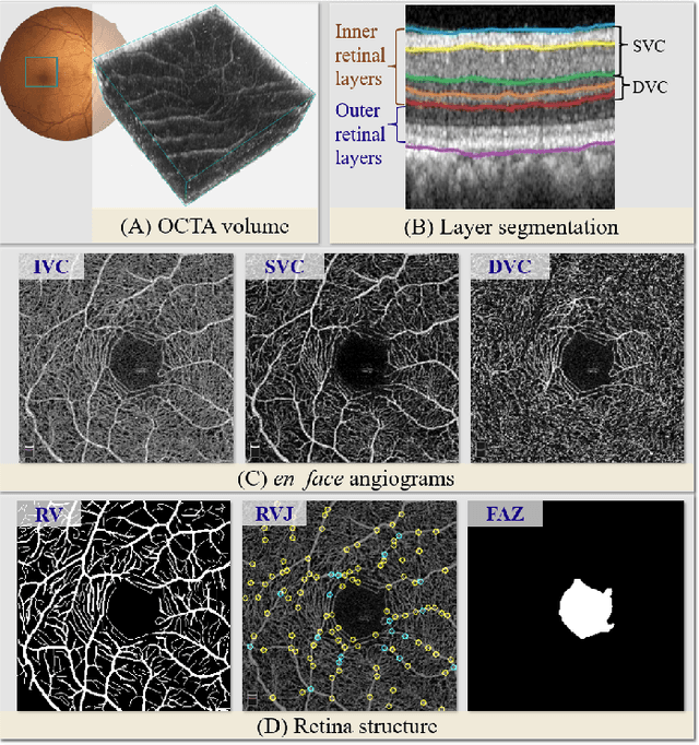 Figure 1 for Retinal Structure Detection in OCTA Image via Voting-based Multi-task Learning