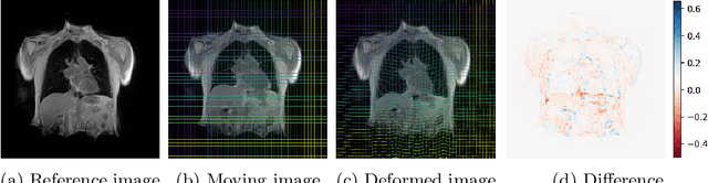 Figure 4 for Linear and Deformable Image Registration with 3D Convolutional Neural Networks