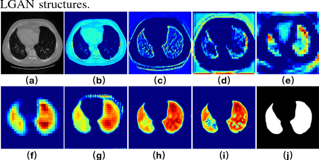 Figure 4 for LGAN: Lung Segmentation in CT Scans Using Generative Adversarial Network