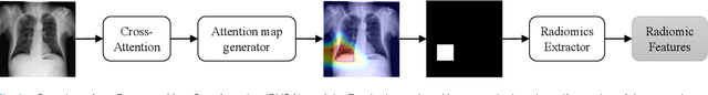 Figure 3 for Radiomics-Guided Global-Local Transformer for Weakly Supervised Pathology Localization in Chest X-Rays