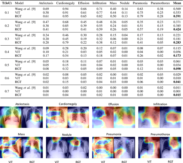 Figure 4 for Radiomics-Guided Global-Local Transformer for Weakly Supervised Pathology Localization in Chest X-Rays