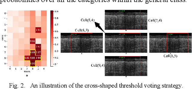 Figure 2 for Cervical Optical Coherence Tomography Image Classification Based on Contrastive Self-Supervised Texture Learning