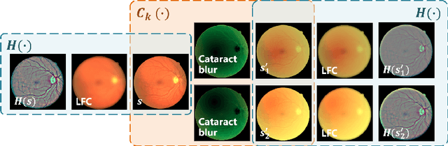 Figure 3 for Structure-consistent Restoration Network for Cataract Fundus Image Enhancement