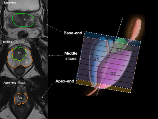 Figure 2 for Automatic Prostate Zonal Segmentation Using Fully Convolutional Network with Feature Pyramid Attention