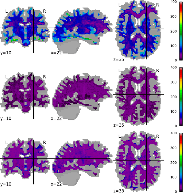 Figure 3 for Scanner Invariant Representations for Diffusion MRI Harmonization