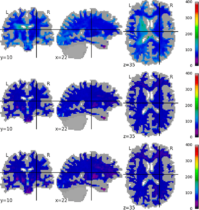Figure 4 for Scanner Invariant Representations for Diffusion MRI Harmonization