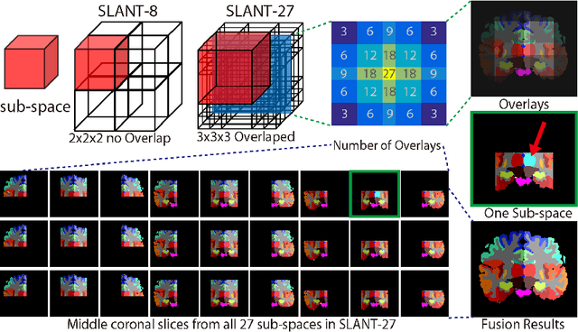 Figure 3 for Spatially Localized Atlas Network Tiles Enables 3D Whole Brain Segmentation from Limited Data