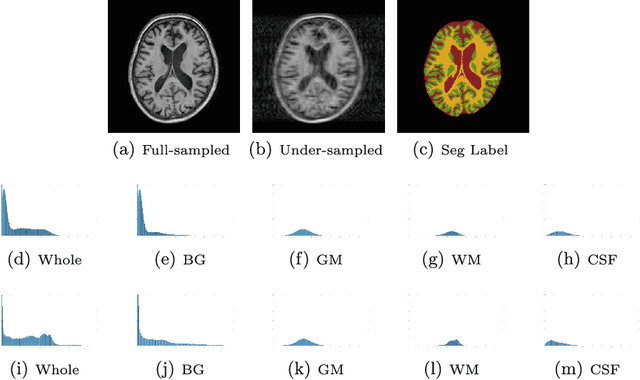 Figure 1 for A Segmentation-aware Deep Fusion Network for Compressed Sensing MRI