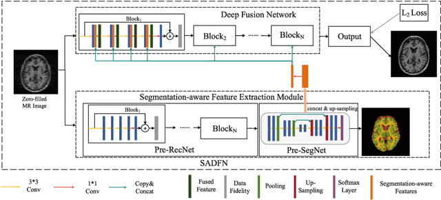 Figure 3 for A Segmentation-aware Deep Fusion Network for Compressed Sensing MRI