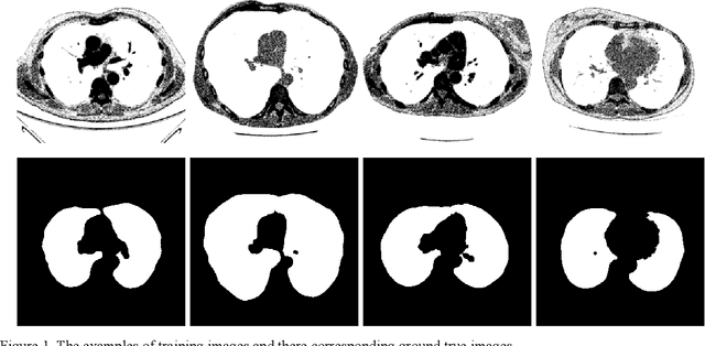 Figure 1 for Lung image segmentation by generative adversarial networks