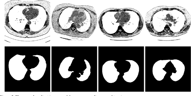 Figure 3 for Lung image segmentation by generative adversarial networks