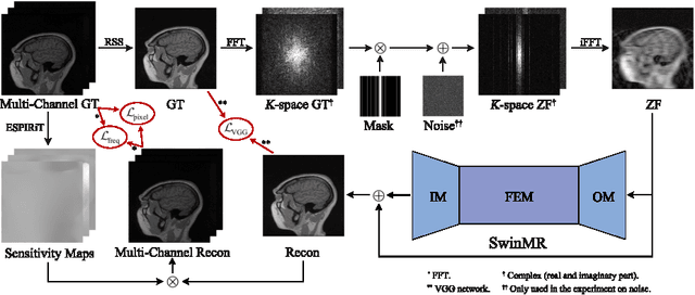 Figure 3 for Swin Transformer for Fast MRI