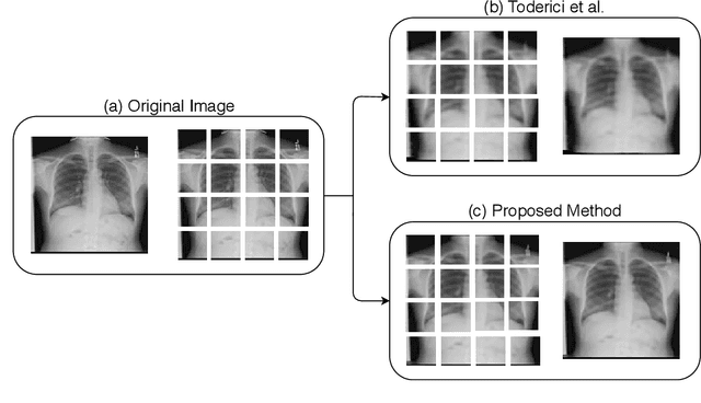 Figure 2 for X-Ray Image Compression Using Convolutional Recurrent Neural Networks