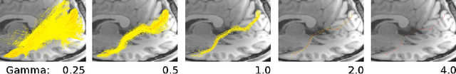 Figure 1 for Measures of Tractography Convergence